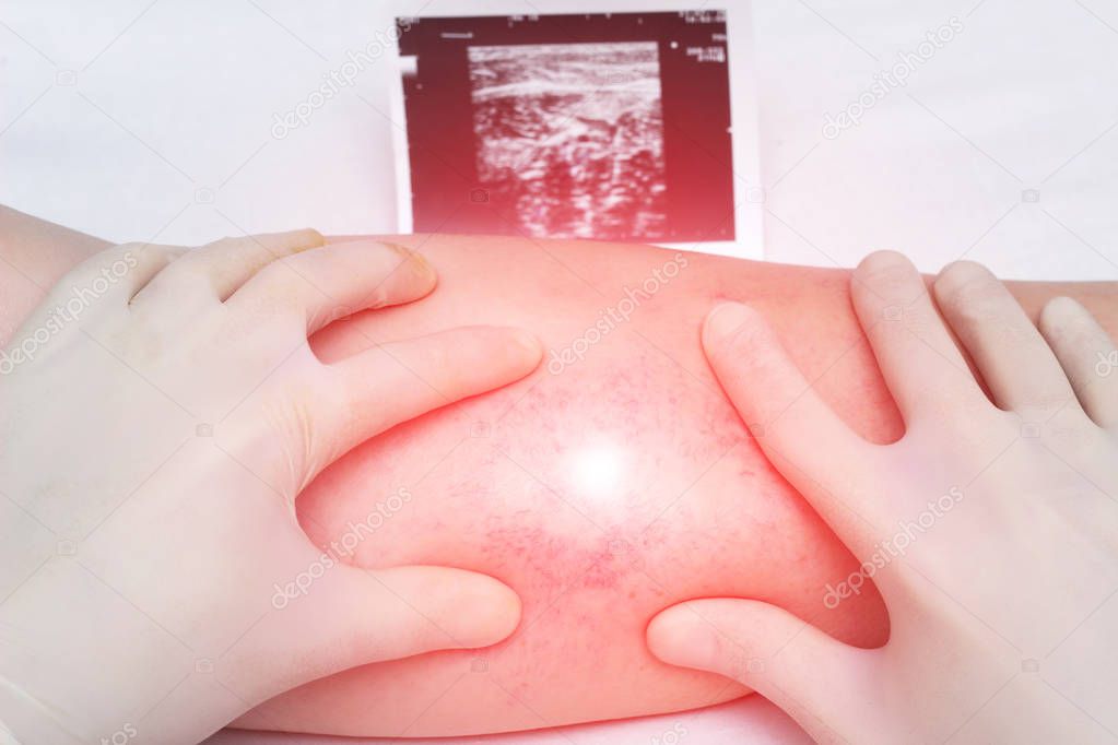 A doctor in gloves examines the veins and legs of the patient for the presence of thrombosis and varicose veins of the extremities, close-up, white background, ultrasound shot, medical