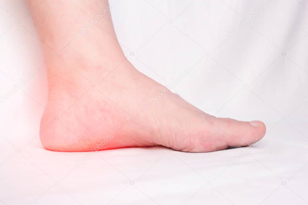Female leg with a sore heel with a heel spur, spike and osteoite in the heel, pain, close-up, white background, copy space