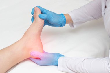 Doctor examines the sore heel of a woman who has a heel spur, orthopedist clipart