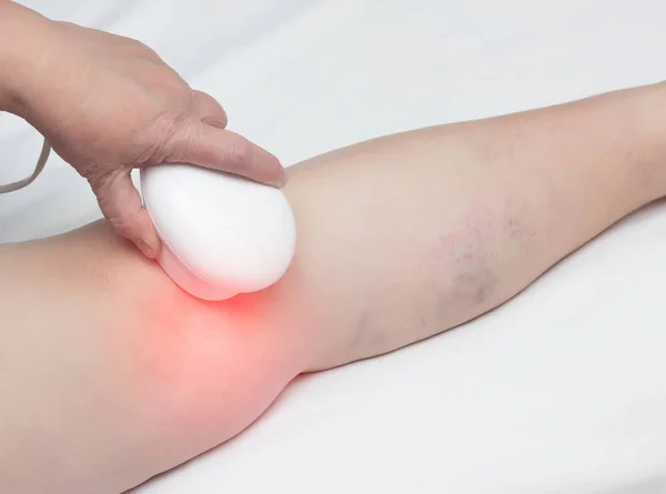 Treatment of osteoarthritis of the knee by magnetic therapy, physiotherapy, inflammation of the knee, close-up — Stock Photo, Image