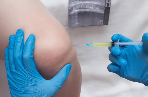 Arzt führt Blutplasma in das Kniegelenk einer Frau ein, um Kniesutsawa, Atrita, Autoplasmotherapie, Nahaufnahme zu behandeln — Stockfoto