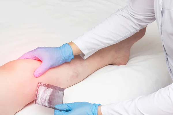 Ortoped drží obrázek ultrazvuk a zkoumá žena s kolenem, diagnostikuje artrózy a artritidy, copys prostor — Stock fotografie