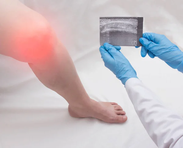 O médico ortopedista mantém uma imagem ultra-sonográfica de uma mulher que tem um joelho dolorido. Gonartrose, artrite, close-up, espaço de cópia, inflamação — Fotografia de Stock