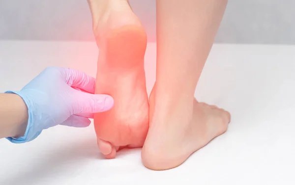 Le médecin examine les pieds du patient pour la mycose et les cors, les talons fissurés, médical, dermatologie, douleur — Photo