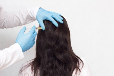 Doktor verir bir hasta bir plasmaplifting hasta s ateş baş büyüme ve plazma terapi saç kalitesini iyileştirmek için