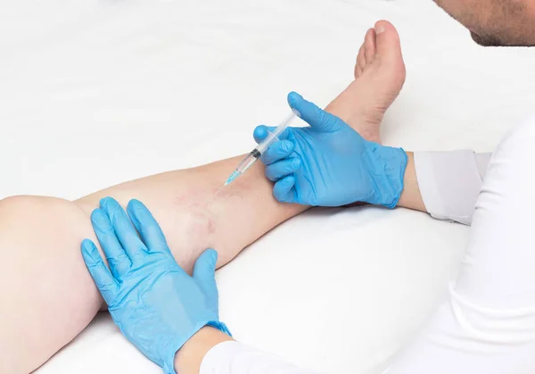 Doktor gerçekleştirir skleroterapi varis bacaklar, varis tedavisi, kopya alanı, tarih için enjeksiyon