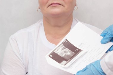 Bir kadın bir endokrinolog, tiroid hormonları tarafından başvurulan bir, Doktor tutar bir ultrason, beyaz arka plan, endokrin sistemi