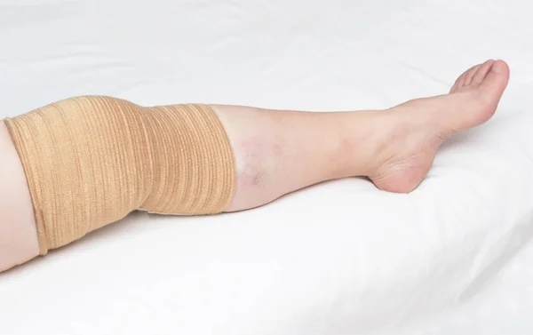 Medical kneecap for fixing the sore knee from osteoarthritis and other diseases, close-up, copy space — Stock Photo, Image