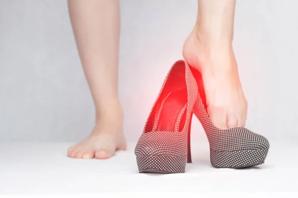 Chica se pone zapatos infecciosos con una infección fúngica y micosis, primer plano, fondo blanco, enfermedad — Foto de Stock