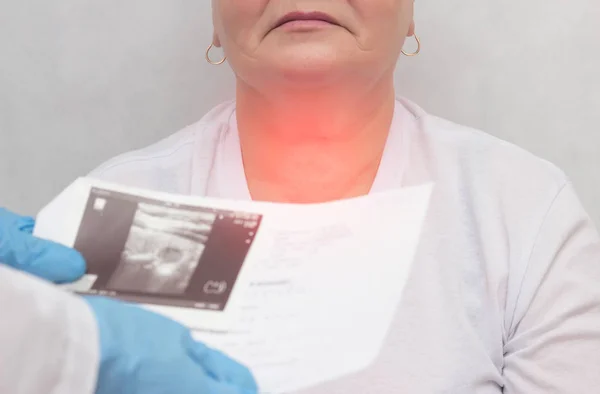 Paziente da un medico con una malattia tiroidea del gozzo nodulare, primo piano, medico, infiammazione — Foto Stock