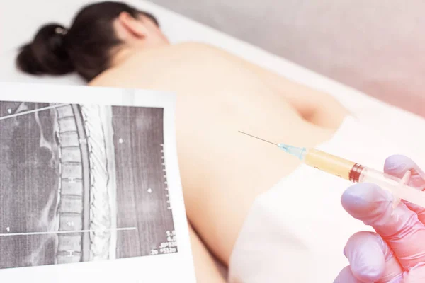 The doctor holds in his hand a snapshot of the spine and plasma-injection prick to treat and eliminate back pain, plasma therapy, medical — Stock Image The doctor holds in his hand a snapshot of the spine and plasma-injection prick to treat and eliminate back pain, plasma therapy, medical Royalty Free Stock Photos