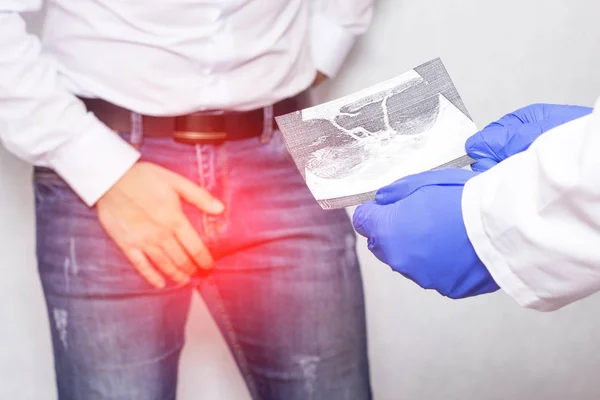 Doktor ürolog hastalar ultrason resmini kimin epididimal kist, orşiti, iltihap tutar.