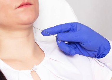 Doktor çift çene hasta bir çift çene Asansör threadlift, yakın çekim, doğal yardımıyla yapar.
