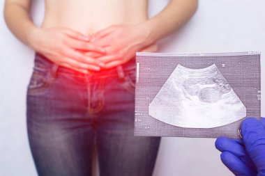 Doctor holds in his hand a snapshot of medical ultrasound examination on the background of a girl with a hernia in the abdomen, pain clipart