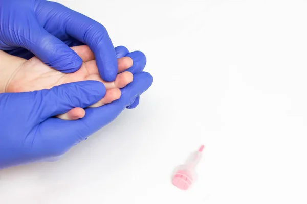 De arts neemt bloed van een vinger een algemene klinische bloedonderzoek van een Verticuteermachine in een kind voor indicatoren van allergieën en ontstekingen, close-up, kopie ruimte — Stockfoto