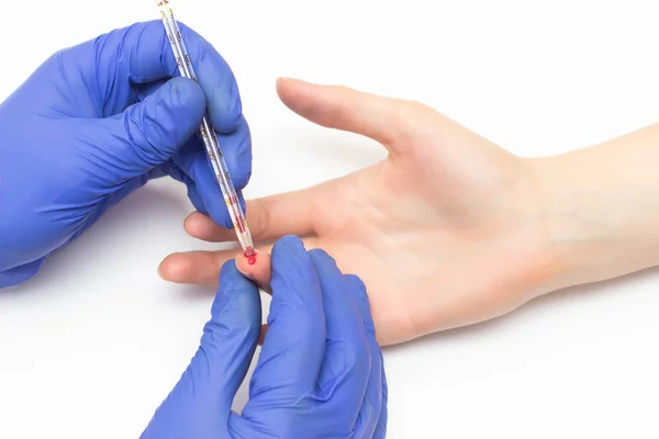 Ο γιατρός κάνει μια γενική εξέταση αίματος για τον ασθενή για το κορίτσι για μια μελέτη των δεικτών των αιμοπεταλίων και soe, γκρο πλαν, ορμόνες — Φωτογραφία Αρχείου