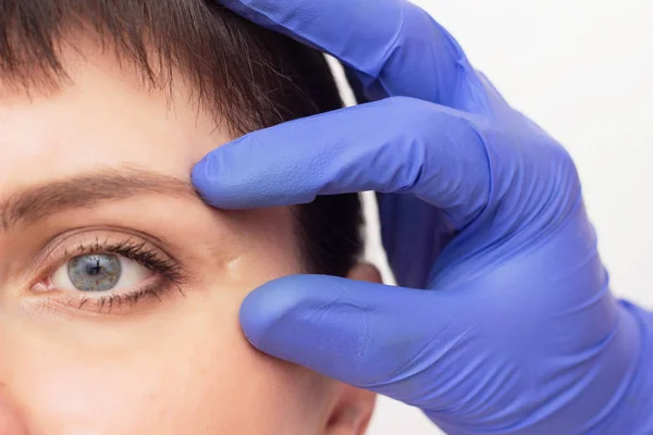 El médico cosmetólogo examina una cicatriz en la cara de la chica, primer plano, piel — Foto de Stock