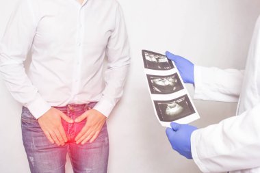A patient with chronic prostatitis and problems with libido at the reception and consultation with a urologist doctor who is holding ultrasound diagnostic images, medical clipart