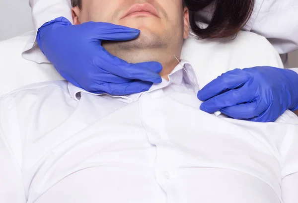 El médico realiza una elevación de la barbilla doble en un hombre joven utilizando el método moderno mesothread, procedimiento — Foto de Stock
