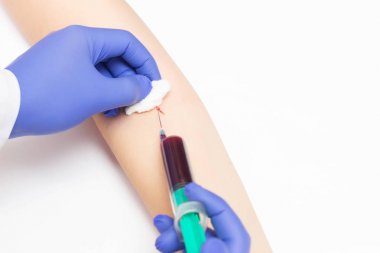 Doktor tiroid hormonları ve otoimmün hastalıklar, yakın çekim, fotokopi alanı, venereoloji çalışmaları için bir kan testi alır