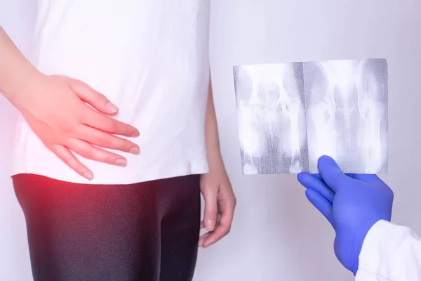 El médico sostiene una imagen de rayos X en el fondo de una niña con dolor en la articulación de la cadera y hernia intervertebral, fibromialgia, primer plano — Foto de Stock