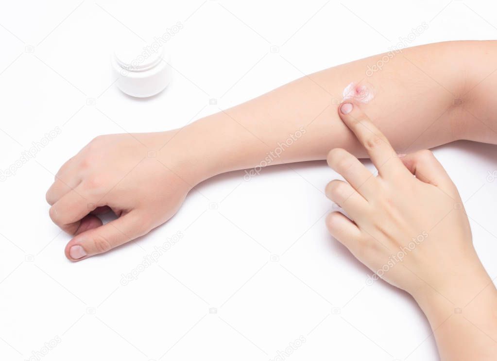 Man smears a medical hormone ointment with a gray red sore pimple on his hand, white background, copy space, dermatology