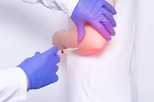 Arts maakt plasma-Lifting injecties in het meisje s ontstoken gewricht om pijn en ontsteking te verlichten, een moderne anti-inflammatoire methode — Stockfoto