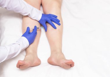 Doktor, bacaklarda varis, miniphlebectomy, kopya alanı olan hastaya skleroterapi enjeksiyonu yapar