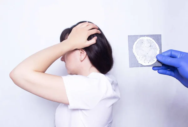 Um médico detém um raio-X de uma menina caucasiana paciente com uma dor de cabeça e contusão cerebral, diagnóstico e tratamento de dores de cabeça, fundo branco — Fotografia de Stock