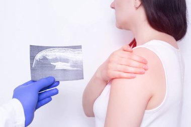 Doktor resepsiyonda genç bir kız beyaz bir arka planda omzunu tutan, Doktor sorunları ve omuz iltihabı ile bir iğne tutuyor, polimyalji