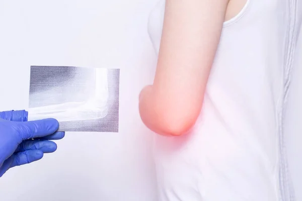 Una ragazza paziente che ha un dolore al gomito a un appuntamento del medico con un esame borsite medica del gomito, primo piano — Foto Stock