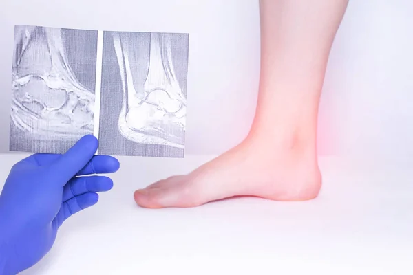 The doctor conducts a medical examination of the ankle joint usi — Stock Photo, Image