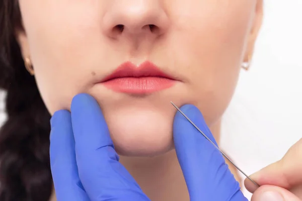Doctor cosmetologist conducts young caucasian girl lip augmentation procedure using a cannula, needles, medical
