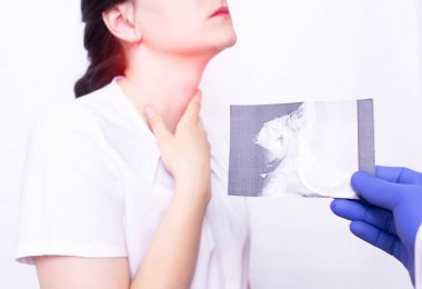 Dr. Ent, adenoidler, bademcik iltihabı, tıbbi nedenlerden dolayı iltihap ve boğaz ağrısı olan genç bir kızın arka planında röntgen resmi tutuyor.