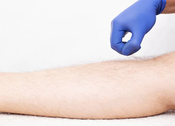 Γιατρός αισθητικός κρατά τα μαλλιά στο χέρι ενός άνδρα στο πόδι, προετοιμασία για την αποτρίχωση με λέιζερ, λευκό φόντο, αντίγραφο χώρου — Φωτογραφία Αρχείου
