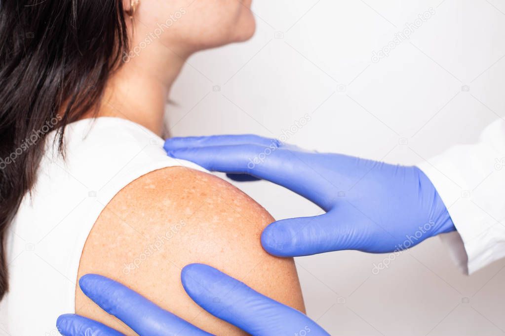 Doctor dermatologist conducts medical examination of problem skin on the patients shoulder, pigment spots on the skin, melanin