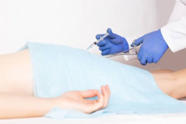 Doktor lateks halkaları ile hemoroid ligating hemoroid kaldırmak için ameliyat yapar, tıbbi, kopya alanı