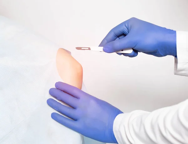 Ο χειρούργος γιατρός κάνει μια τομή με ένα νυστέρι στην άρθρωση του αγκώνα για να αντικαταστήσει μια τραυματισμένη άρθρωση με μια τεχνητή άρθρωση αντικατάστασης, συσκευή κάψας συνδέσμου — Φωτογραφία Αρχείου
