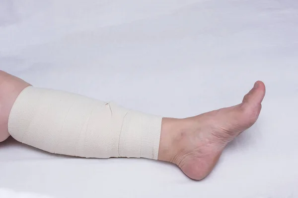 Нога пожилой женщины, перевязанная эластичной повязкой против варикозных вен на ноге, крупный план, белый фон, флеборизм, артерии, травма — стоковое фото
