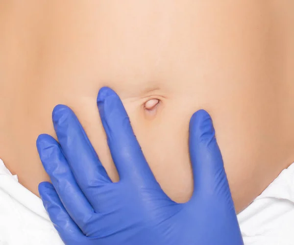 En plastikkirurg läkare undersöker en navel av en flicka innan en umbiloplasty operation, kopiera utrymme, navel kirurgi — Stockfoto
