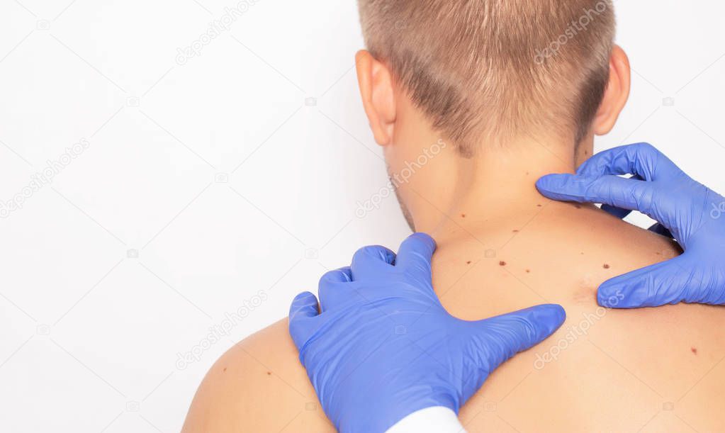 Doctor oncologist examines the body of a male patient for malignant moles, nevus, skin cancer, copy space, fibroma