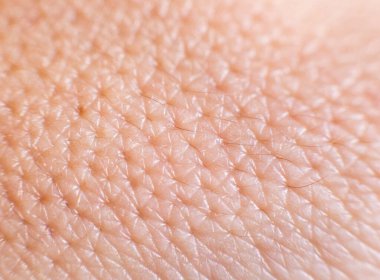 Closeup of porous oily human skin. Large pores on the skin, background, macro, cosmetology clipart