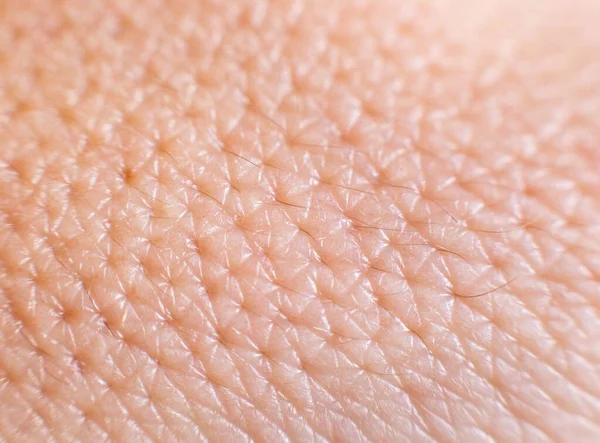 Zbliżenie porowatej, tłustej ludzkiej skóry. Duże pory na skórze, tło, makro, kosmetologia — Zdjęcie stockowe