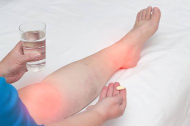 Eklemlerinde bir hap ve bir bardak su tutan bir kadın. Eklem iltihabı ve eklem iltihabı ilaçlarının, vitaminlerin ve kondrokorların tedavisi