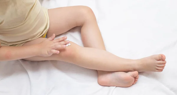 小孩在膝盖的皮肤上擦儿童的治疗膏 儿童皮肤刺激 过敏和皮肤干燥的治疗概念 — 图库照片