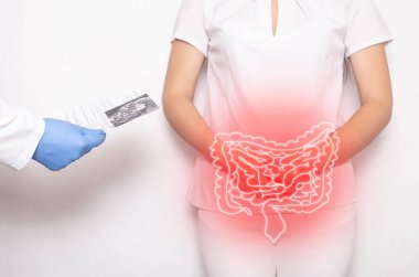 Doktor, beyaz arka planda kadın hastanın muayenesinin sonuçlarını tutuyor. Bağırsak iltihabı ve hastalık konsepti, karın ağrısı, dolichosigma
