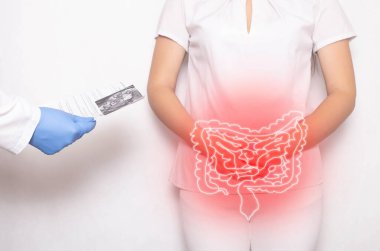 The doctor holds the results of the examination of the female patient on a white background. Bowel inflammation and disease concept, abdominal pain, dolichosigma clipart