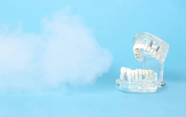 Dental Jaw Model Blue Background Ozone Concept Dental Treatment Ozone — Stock Photo, Image
