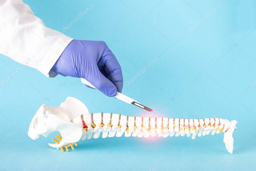 Doctors hand with a scalpel near the mock up of the human spine on a blue background. Spine surgery concept, vertebroplasty, copy space for text, minimally invasive surgery