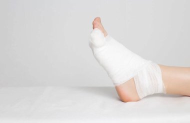 Mans bandaged foot with little finger on a white background. The concept of a fracture of the little finger on the leg with offset, copy space, deformation clipart